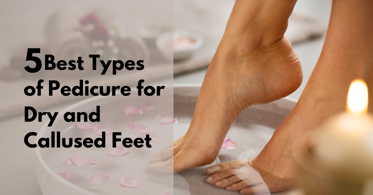 5 Best Types of Pedicure for Dry and Callused Feet